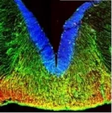 Human midbrain development